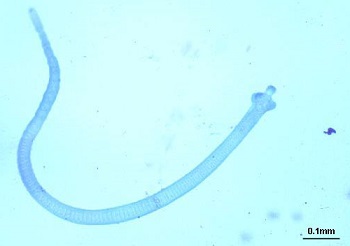 Hymenolepis Nana Life Cycle Pathogenesis Pathology Host Immunity hymenolepis-nana-life-cycle-pathogenesis-pathology-host-immunity